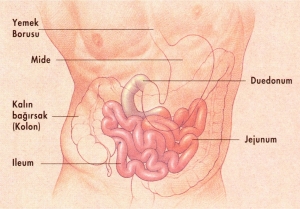 Ostomi Nedir