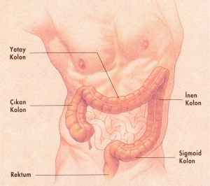 Ostomi Nedir